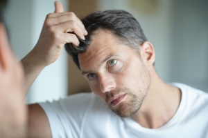 Intensyvus plaukų slinkimas - didelė problema ne tik moterims, bet ir vyrams